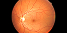 image of retina eye