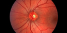 image of neuro